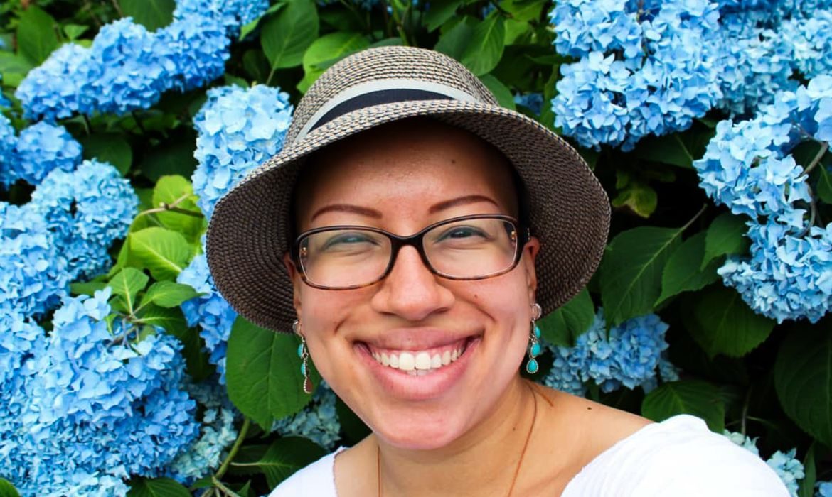 Pacientes com alopecia areata compartilham jornadas de superação