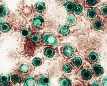 1 em cada 8 casos de câncer provavelmente é causado por infecções, diz estudo