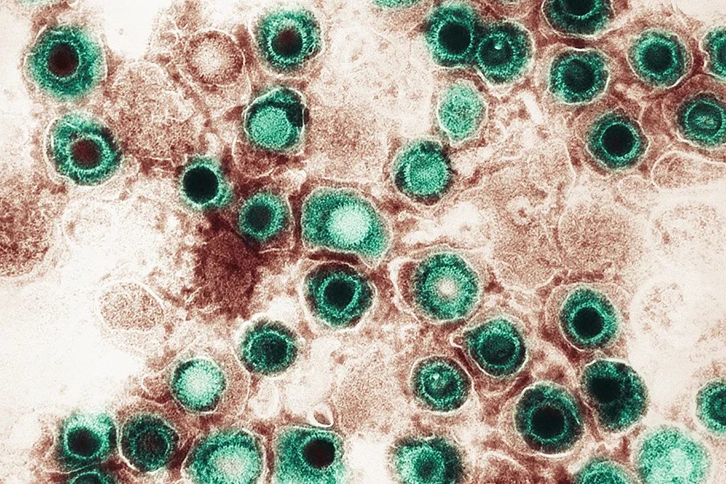Câncer ligado a infecções atinge 12% dos casos globais, aponta OMS