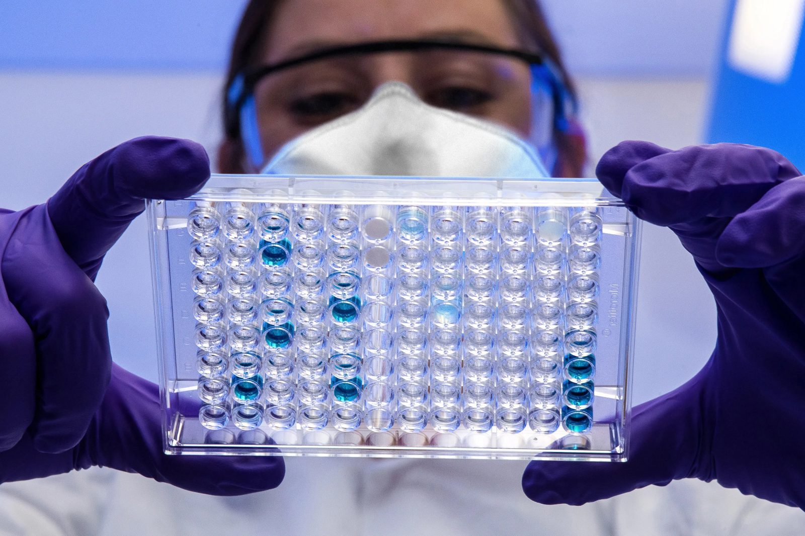 Amiloidose hereditária: consulta pública debate novo tratamento no SUS