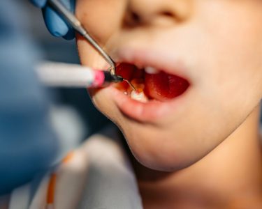 Crianças brasileiras vão ao dentista pela primeira vez só aos 7 anos, aponta levantamento