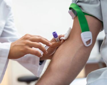 Sorologia: o que é, para que serve e quais testes fazer periodicamente