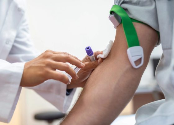 Sorologia: o que é, para que serve e quais testes fazer periodicamente